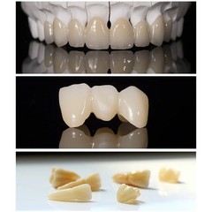 C14 Dental Emax Lithium Disilicate Glass Ceramic Blocks CEREC CAD CAM Crown LT