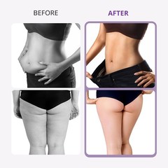 9 in 1 Beauty Machine for Body Massage Facial Skin Care Skin Lifting Lost WeigkY