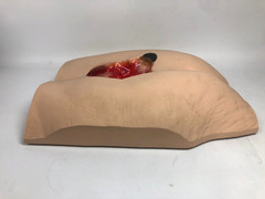 VATA ‘Stan’ Stage IV Pressure Ulcer Model 0970 with Carry Case