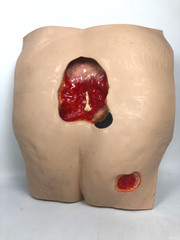VATA ‘Stan’ Stage IV Pressure Ulcer Model 0970 with Carry Case