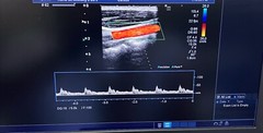 CANON TOSHIBA LINEAR ARRAY Transducer 10L4 MODEL: PLT-604AT D.O.M: JULY 2015