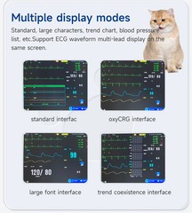 Multi-parameter Patient Monitor Vital Signs Monitor ECG/NIBP/TEMP/RESP/SPO2/PR