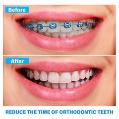 45 Color Dental Elastic Ligature Ties Rubber Power Bands for Orthodontic Braces