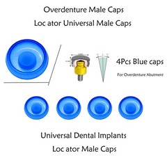 US ZEST Locator Replacement Retention Male Caps Inserts For Dental Overdenture