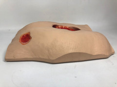 VATA ‘Stan’ Stage IV Pressure Ulcer Model 0970 with Carry Case