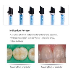 Dentex Dental Universal Composite Resin Light Cure A1/A2/A3/A3.5/B1/B2