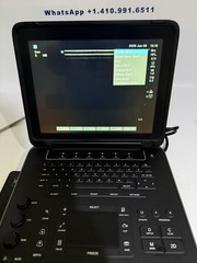 SonoSite Edge II Ultrasound | Factory Refurb | Probe Choice I 1-Year Warranty