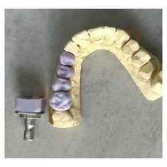 US Dental Lithium Disilicate Glass Ceramic Blocks C14 HT CAD CAM CEREC Blocks