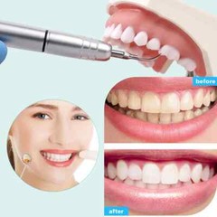 Dental Ultrasonic Air Scaler W/ 3 Tips Teeth Cleaning 2 Holes/4 Holes Handpiece