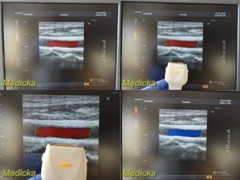 2011 Toshiba PLT-604AT Linear Array Ultrasound Transducer Probe, 6.0Mhz ~ 30191