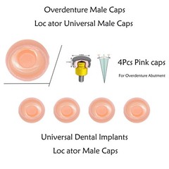 US ZEST Locator Replacement Retention Male Caps Inserts For Dental Overdenture